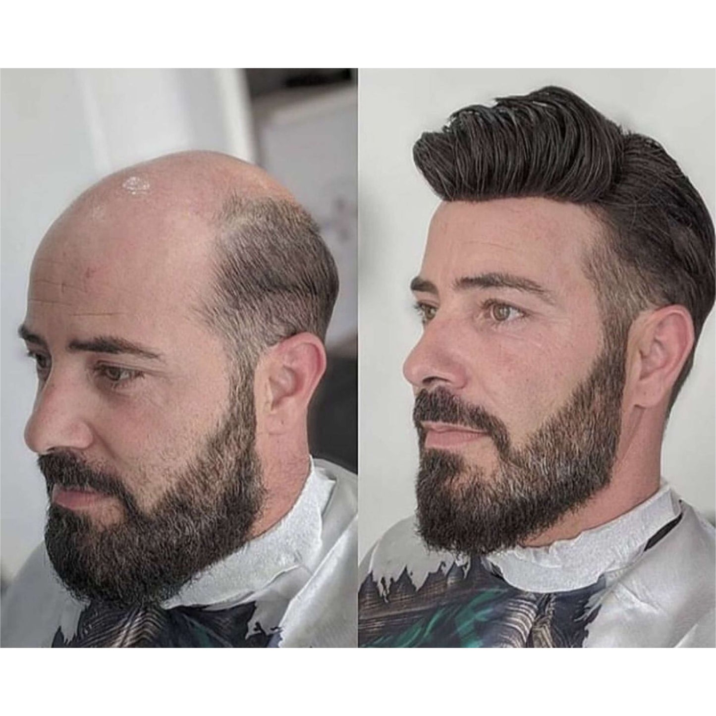 Upgrade Mirage |0.04-0.06mm Full Super Thin Skin Single Knots Base | Toupee for Men | Celebrities Choice