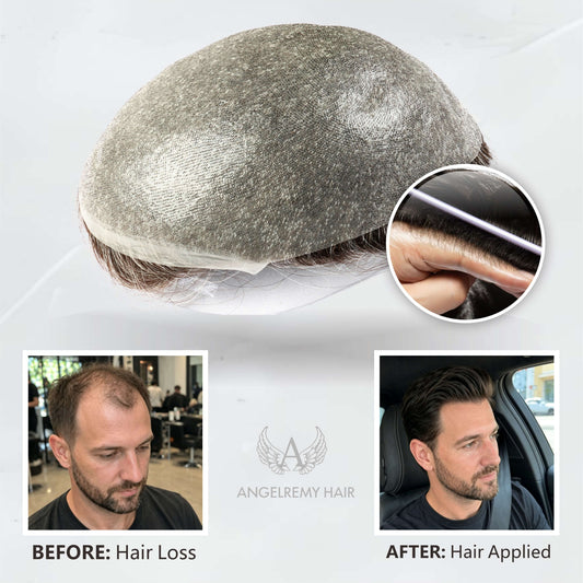 Mejora Mirage |0.04-0.06mm Piel Súper Fina Nudos Simples | Toupee para Hombres | La Elección de las Celebridades