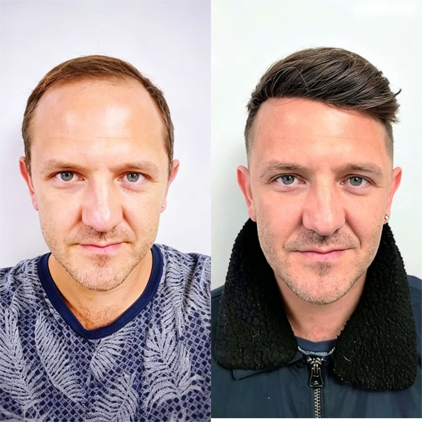 Upgrade Mirage |0.04-0.06mm Full Super Thin Skin Single Knots Base | Toupee for Men | Celebrities Choice