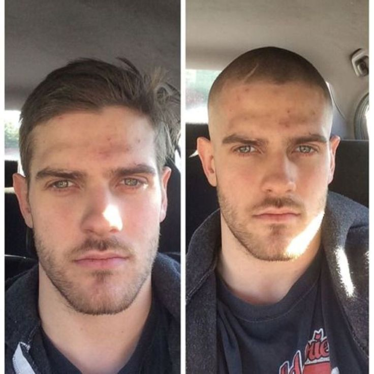 Upgrade Mirage |0.04-0.06mm Full Super Thin Skin Single Knots Base | Toupee for Men | Celebrities Choice